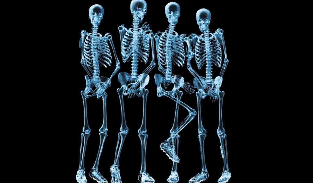 Funny Skeletons Xray