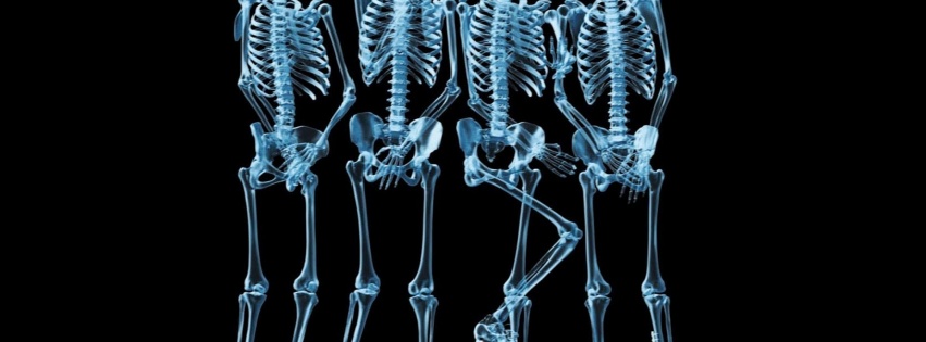 Funny Skeletons Xray