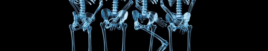 Funny Skeletons Xray